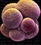 image:stemcell1.jpg